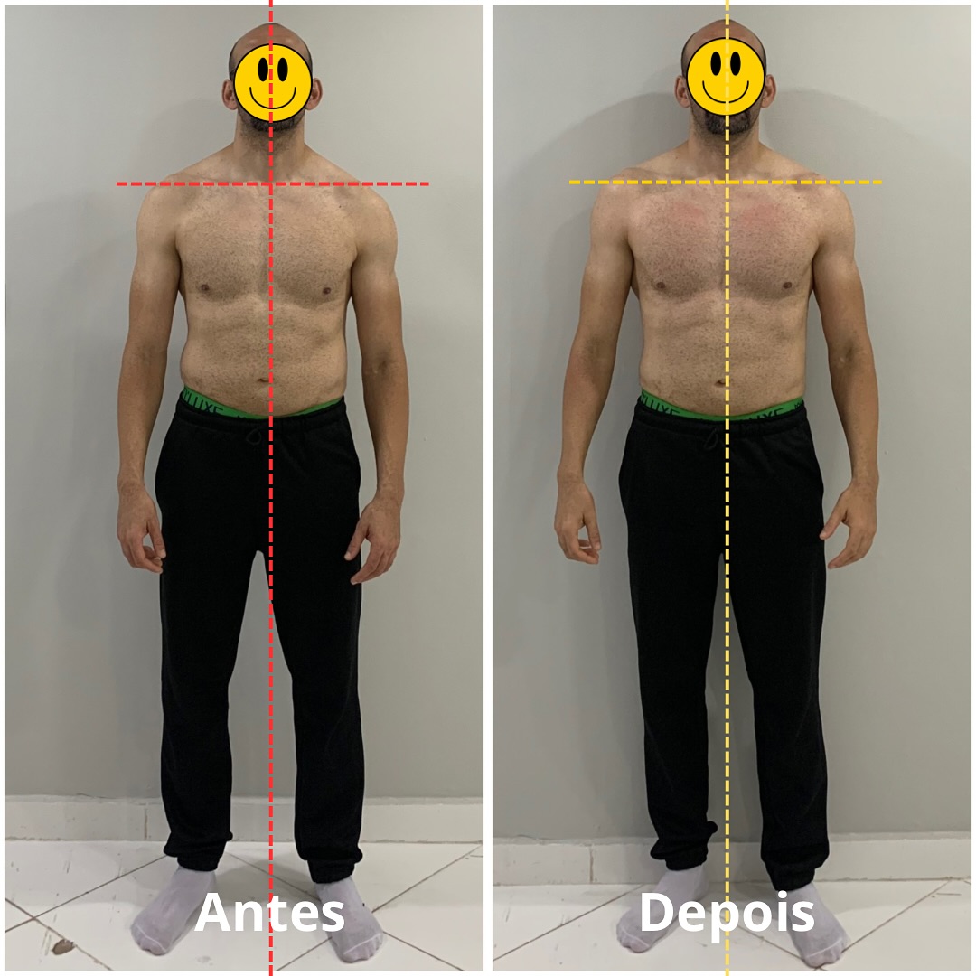 Postura e prevenção de dores crônicas - Rodrigo Stabile Terapeuta Manual