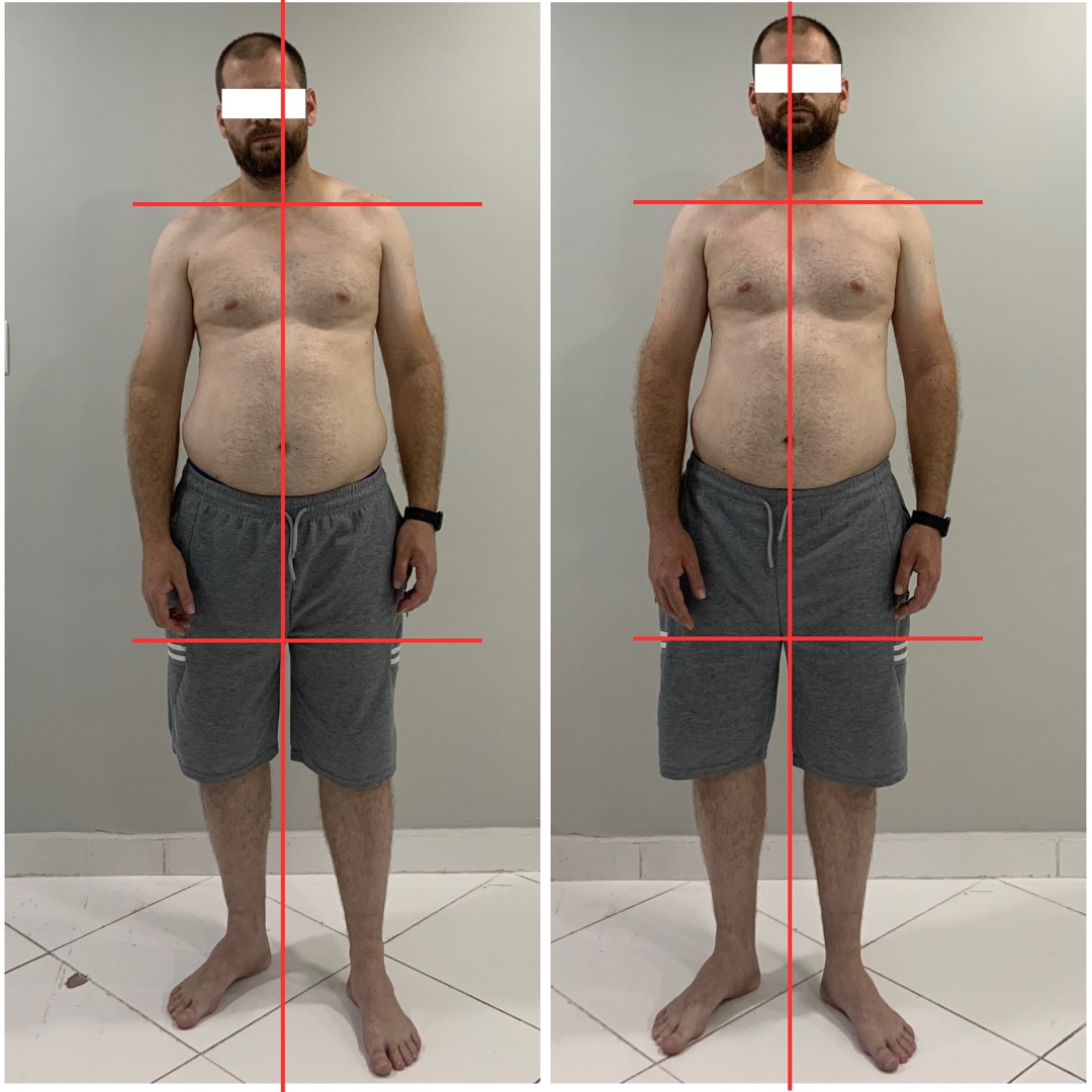 Tratamento de dor lombar e cervical com Terapia Manual - Rodrigo Stabile